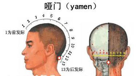 啞門穴→治音啞、頭痛